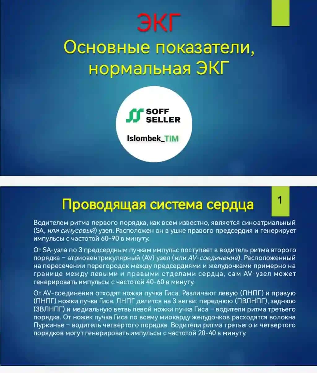 ЭКГОсновные показатели, нормальная ЭКГ