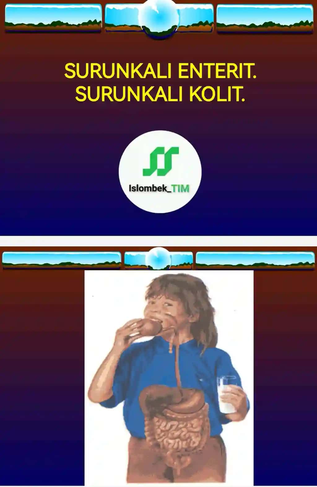 SURUNKALI ENTERIT. SURUNKALI KOLIT.