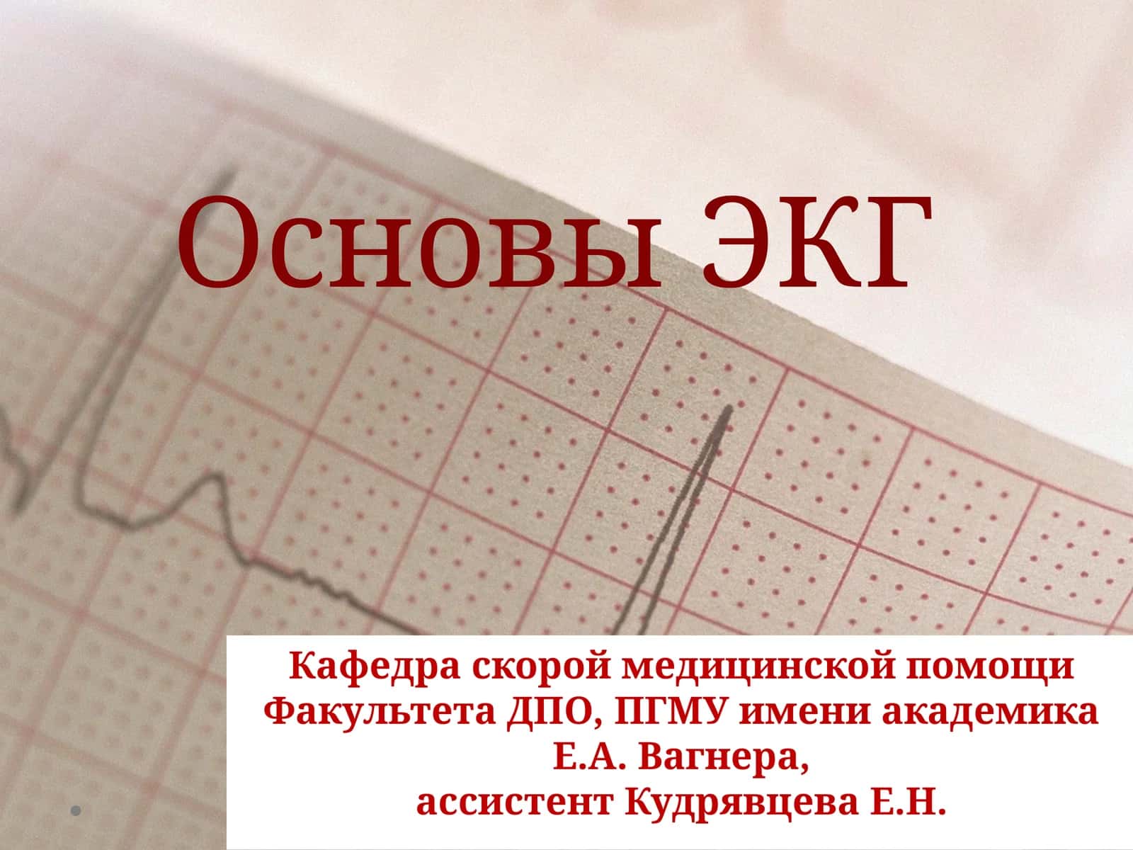 Основы ЭКГ