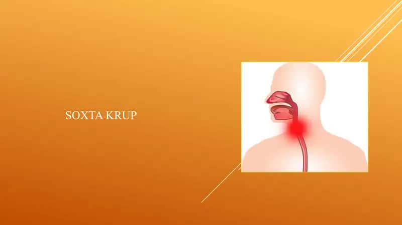 SOXTA KRUP