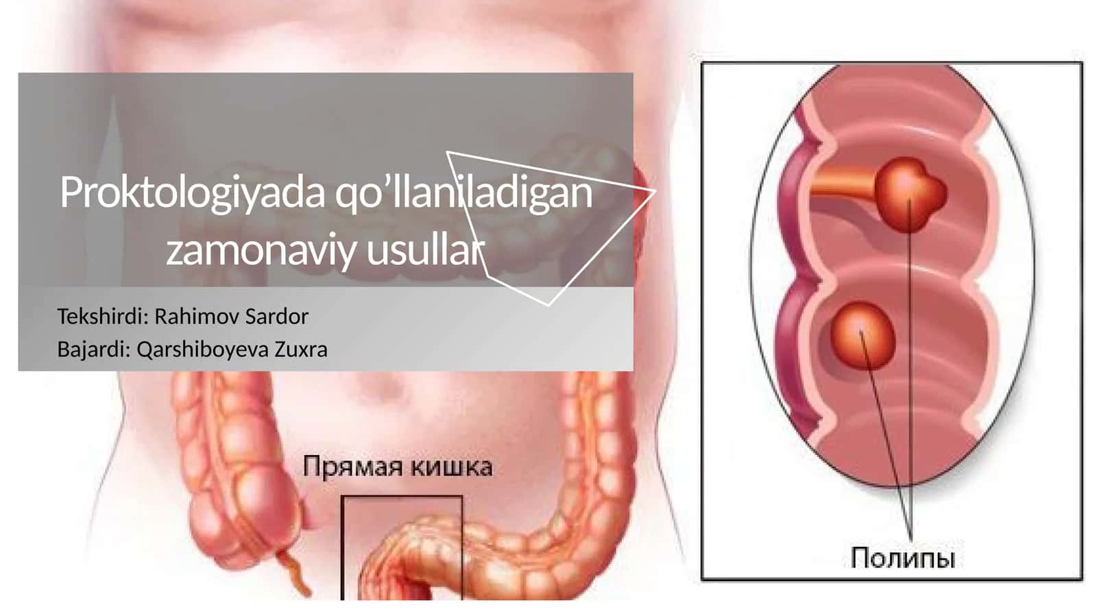 Proktologiyada qo’llaniladigan zamonaviy usullar