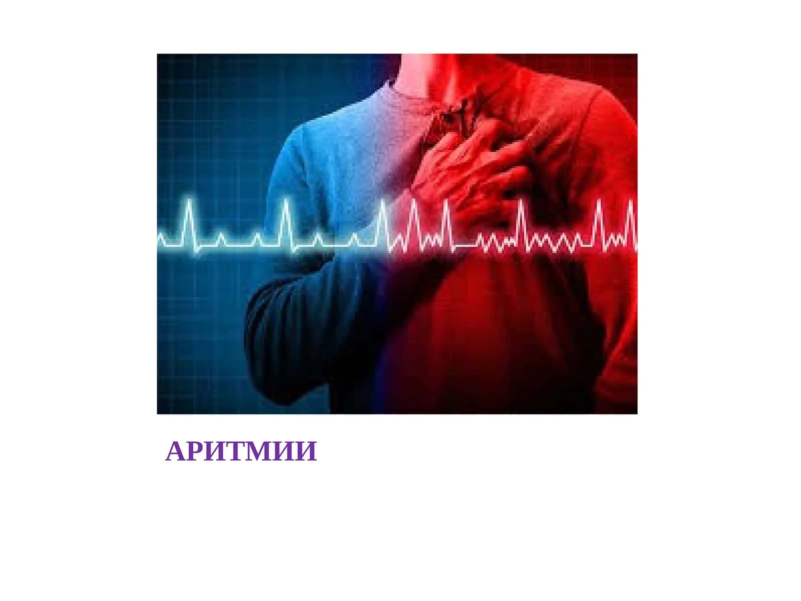 АРИТМИИ