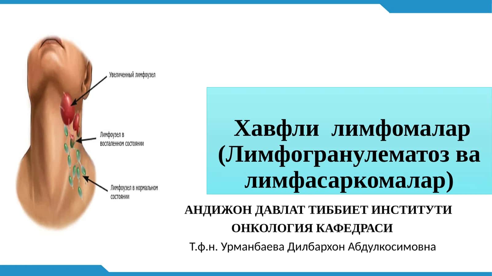 Хавфлилимфомалар(Лимфогранулематозвалимфасаркомалар)