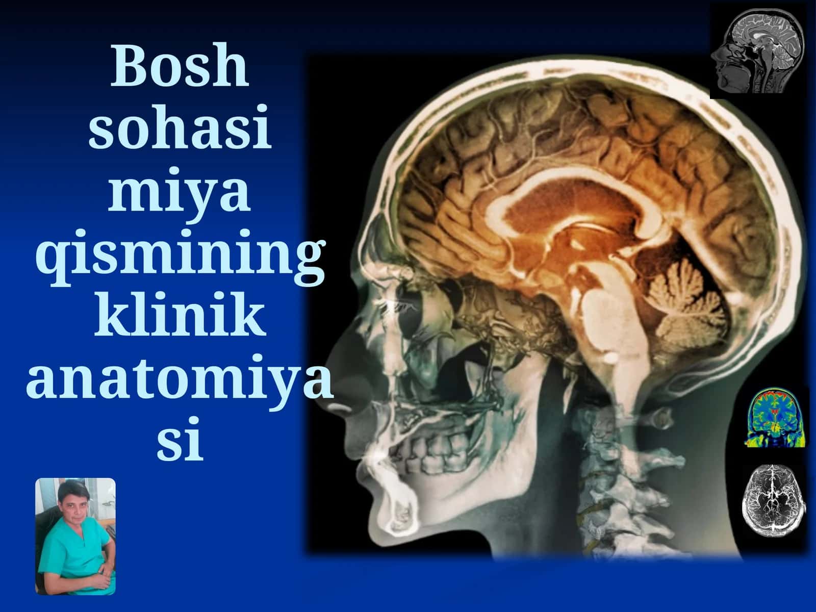Bosh sohasi miya qismining klinik anatomiyasi