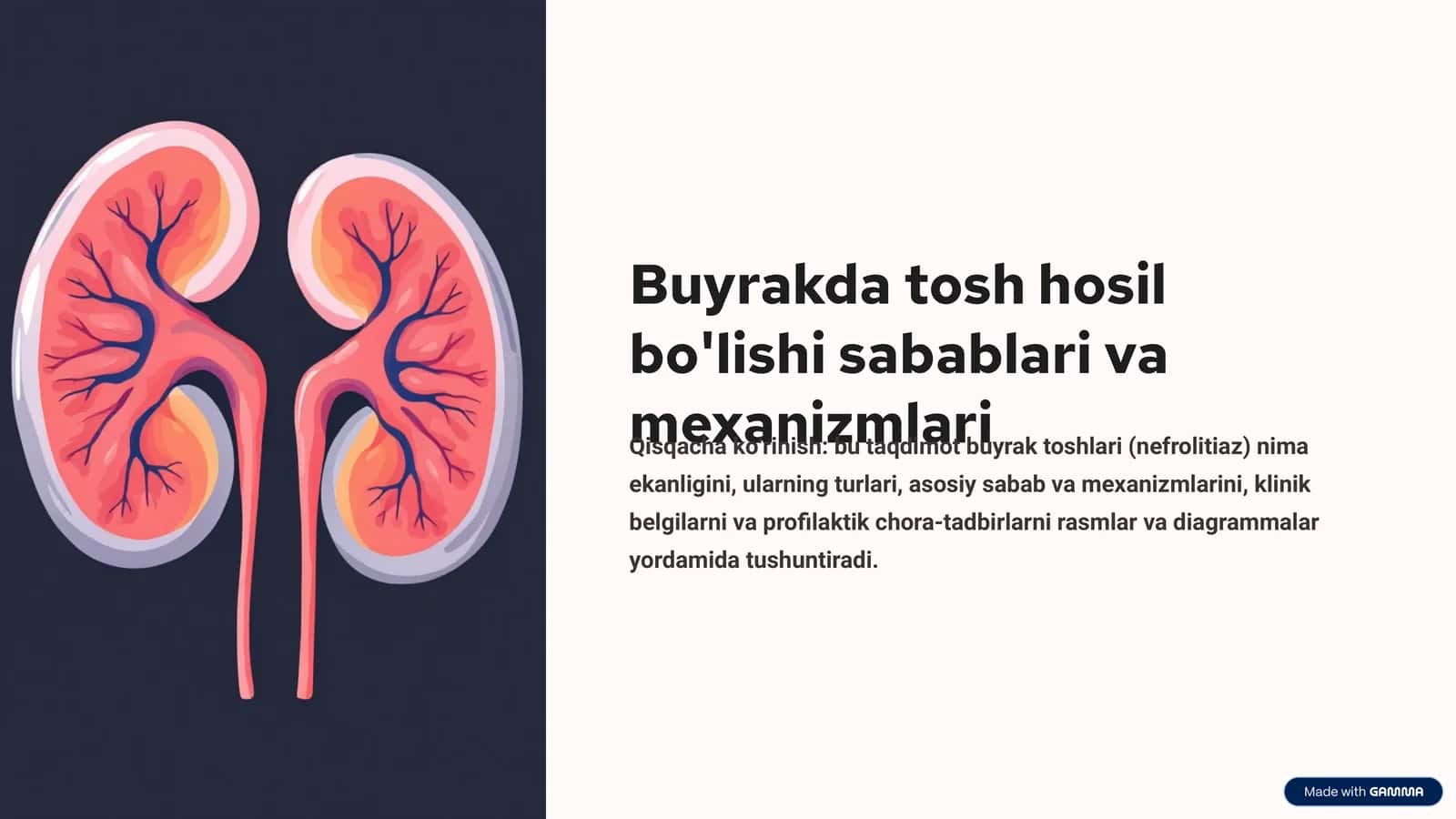 Buyrakda tosh hosil bo'lishi sabablari va mexanizmlari