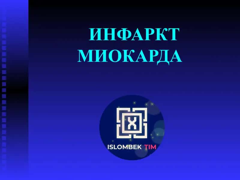 ИНФАРКТ МИОКАРДА