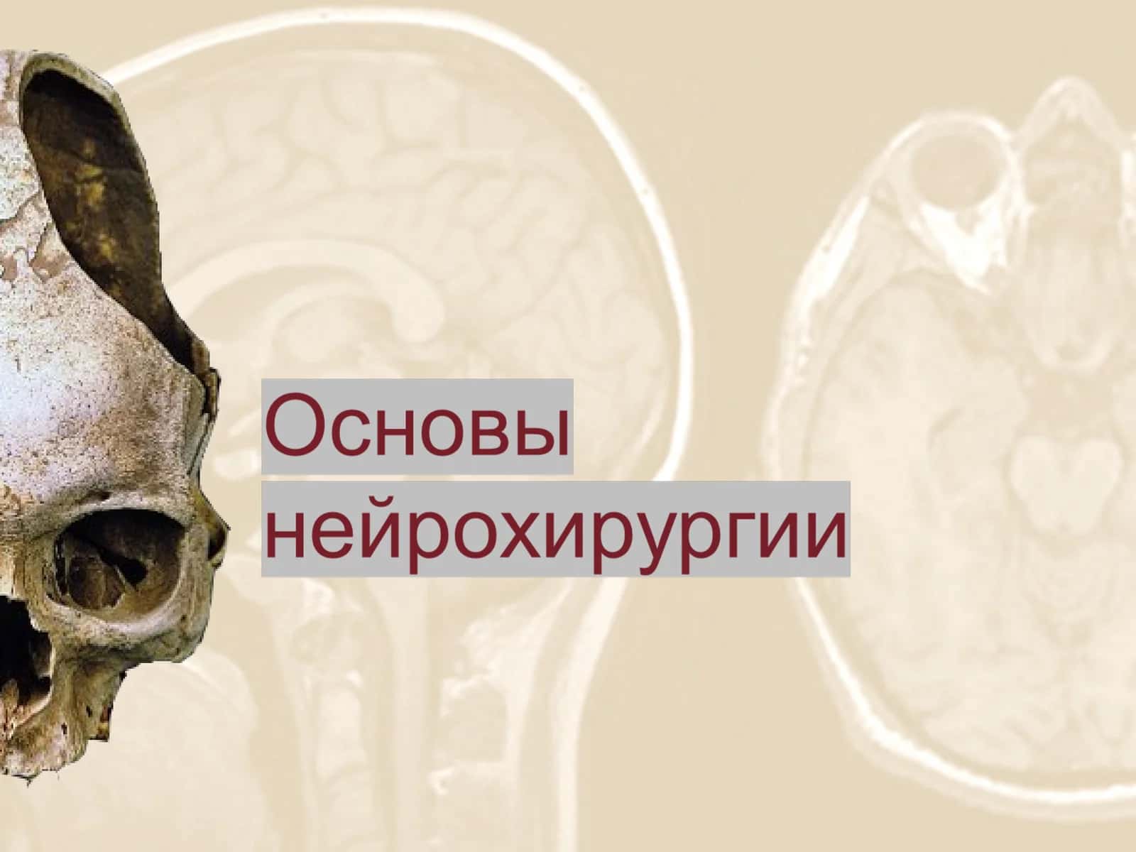 Нейрохирургия