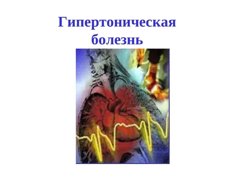 Гипертоническая болезнь