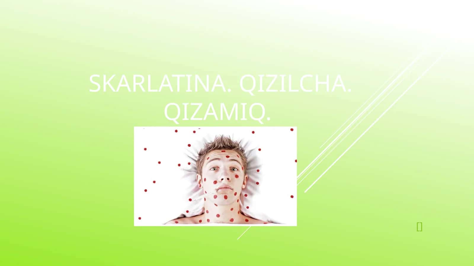 Qizamiqkasalligi, Qizilchakasalligi, Skarlatina