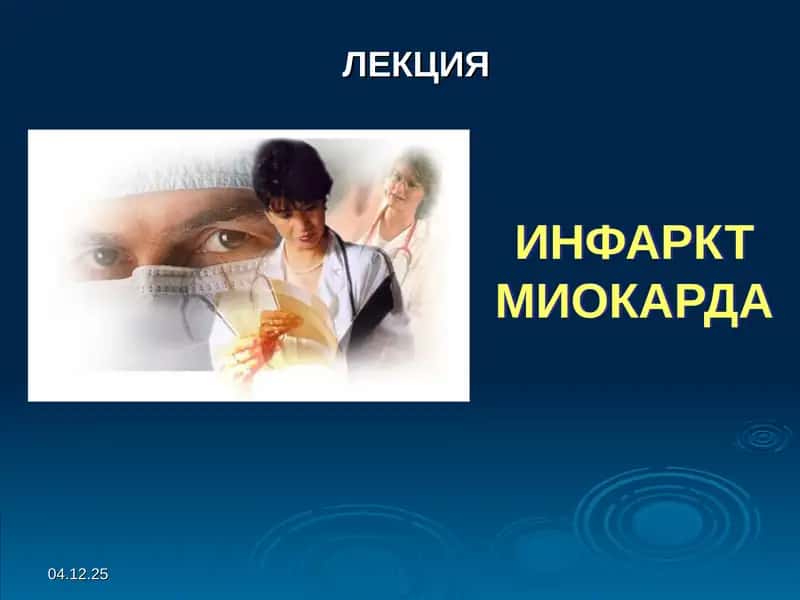 Miokard infarkti