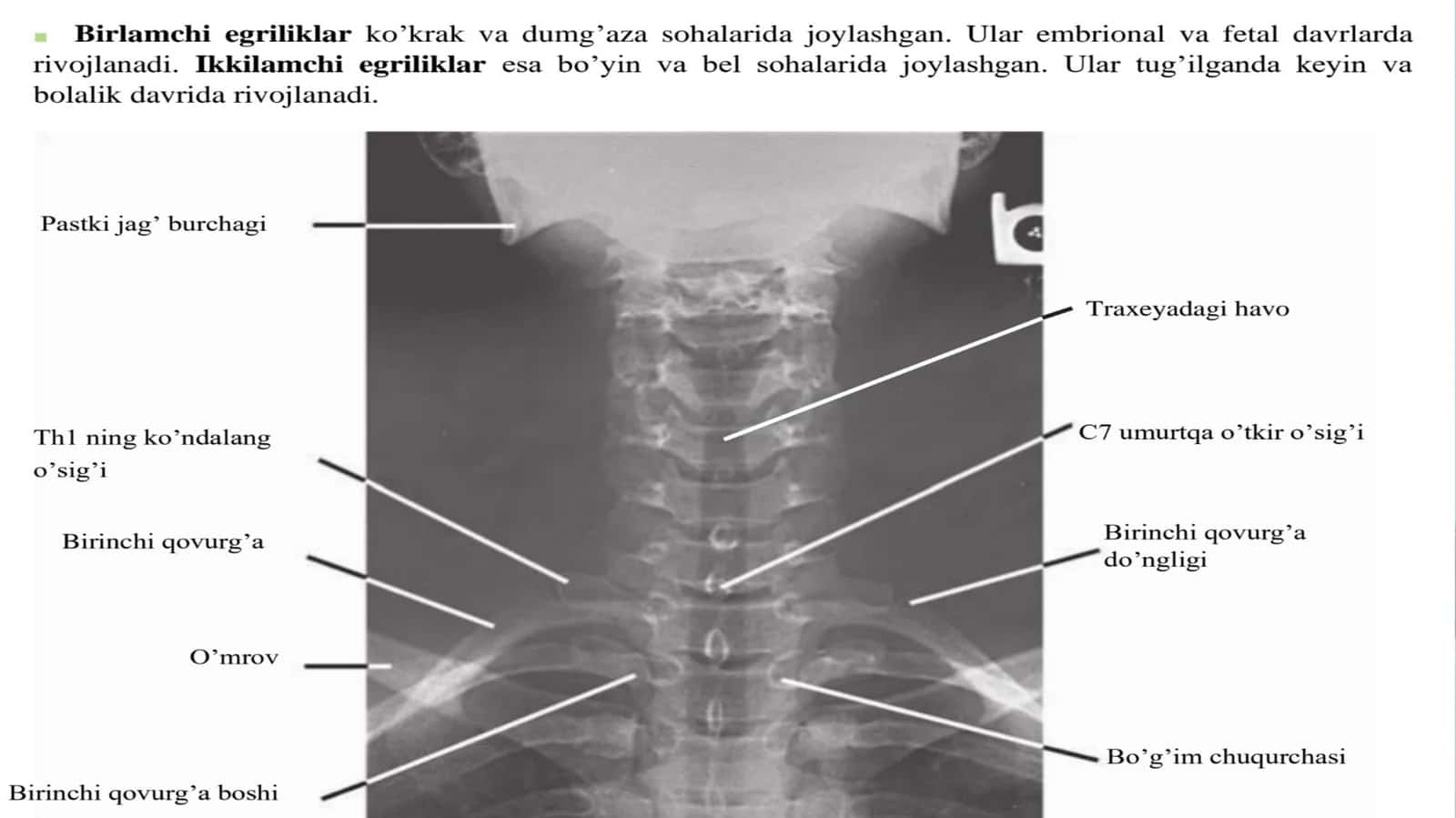Umurtqapog'onasiningabnormalegriliklari
