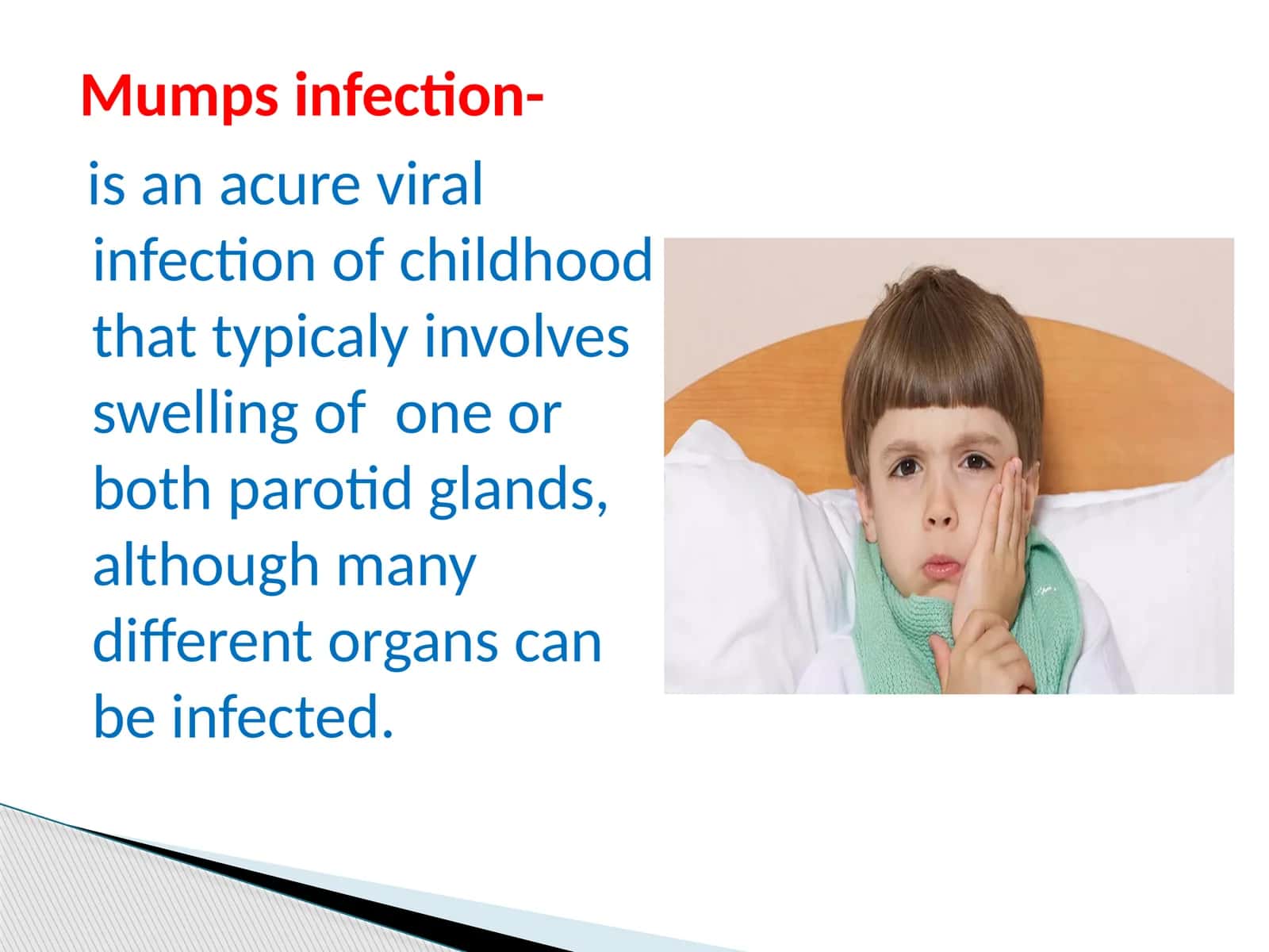 Mumps infection