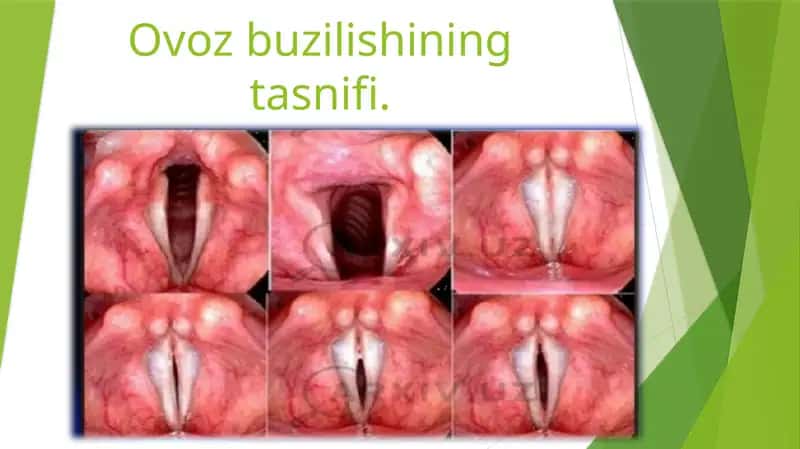 Ovozbuzilishining tasnifi