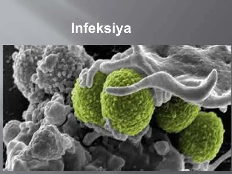 Infeksiya