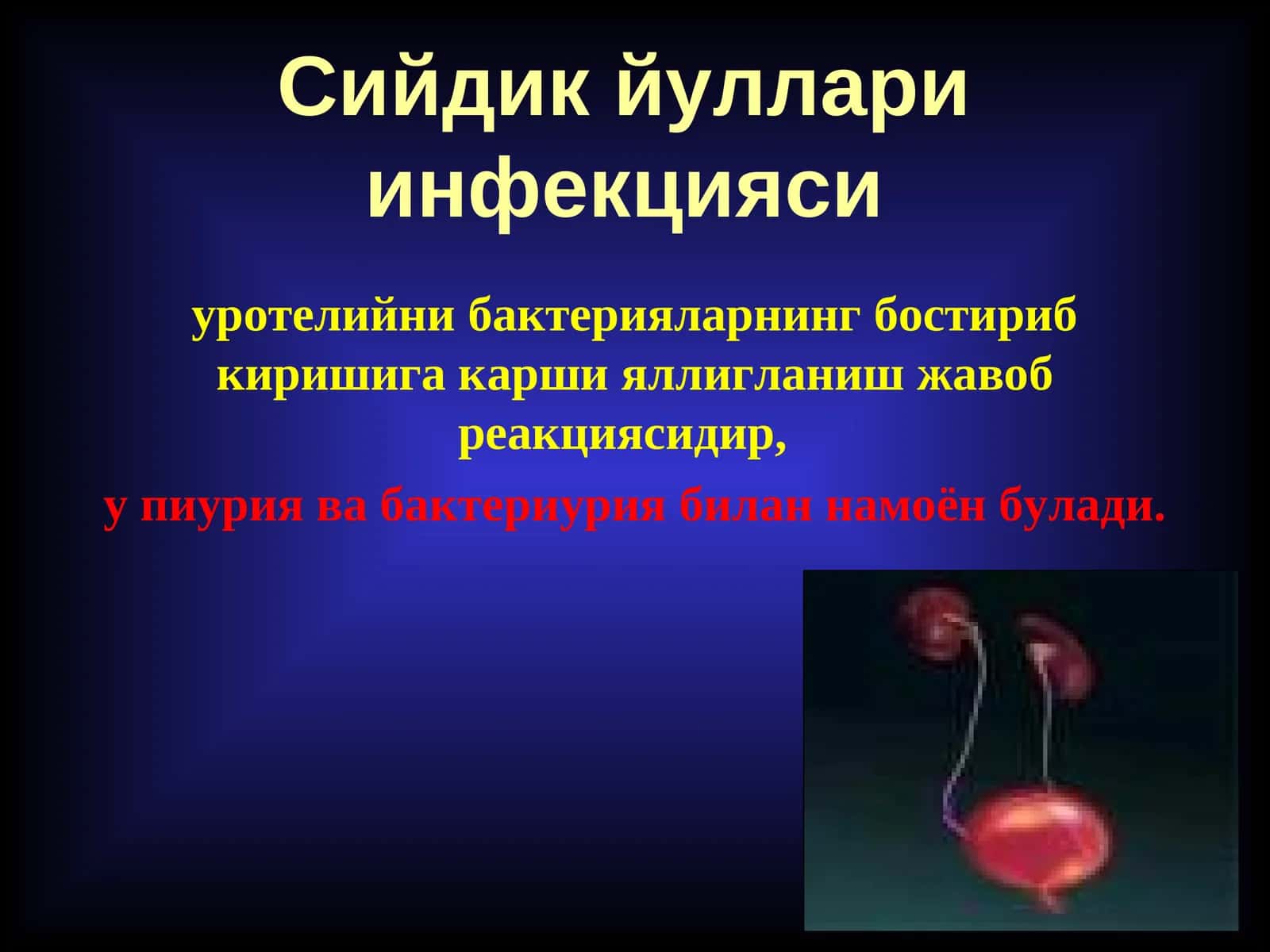 Сийдик йуллари инфекцияси