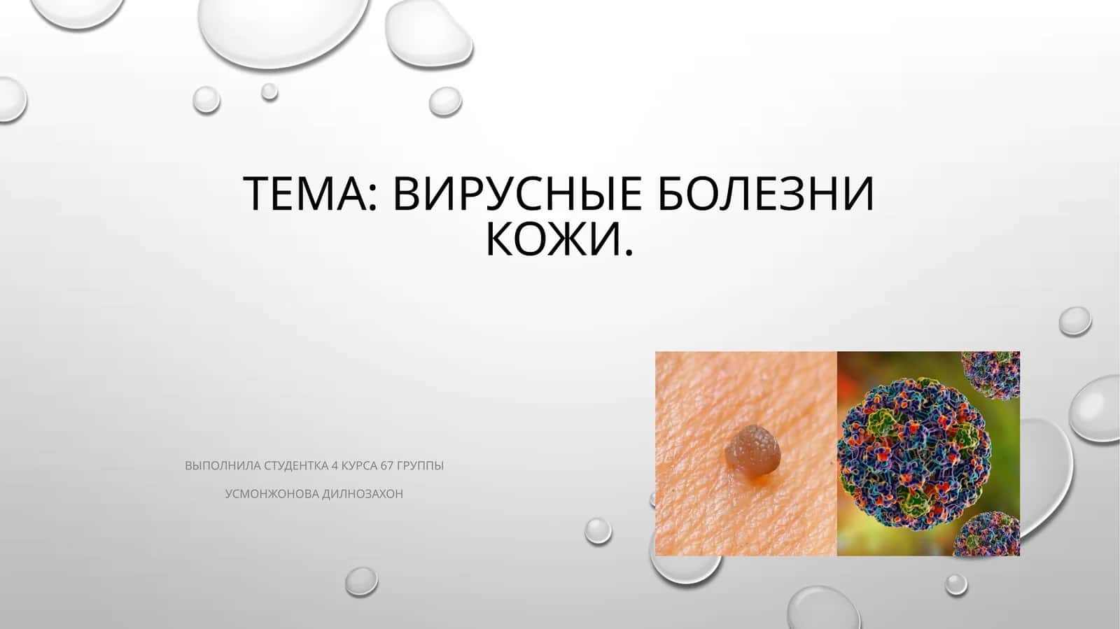 Вирусные болезни кожи