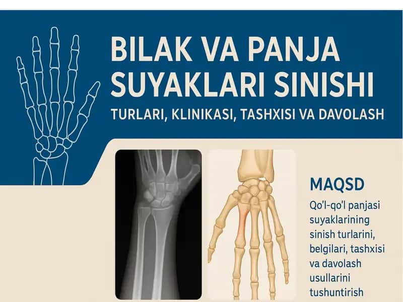 Bilak va panja suyaklari sinishi