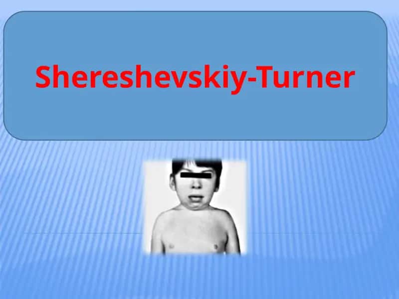 Shereshevskiy-Turner