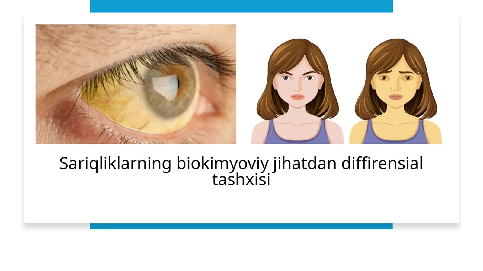 Sariqliklarning biokimyoviy jihatdan diffirensial tashxisi