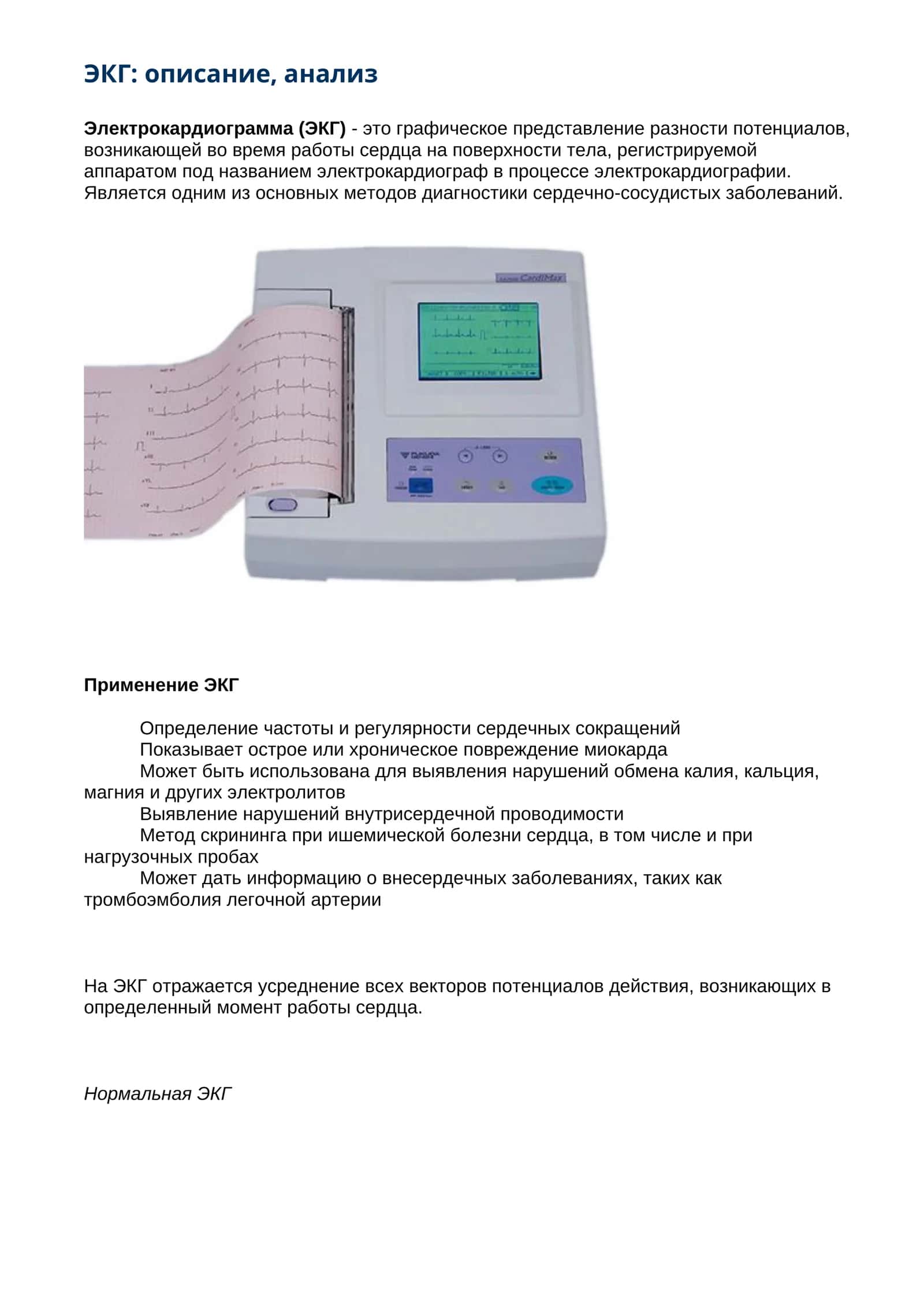 ЭКГ: описание, анализ