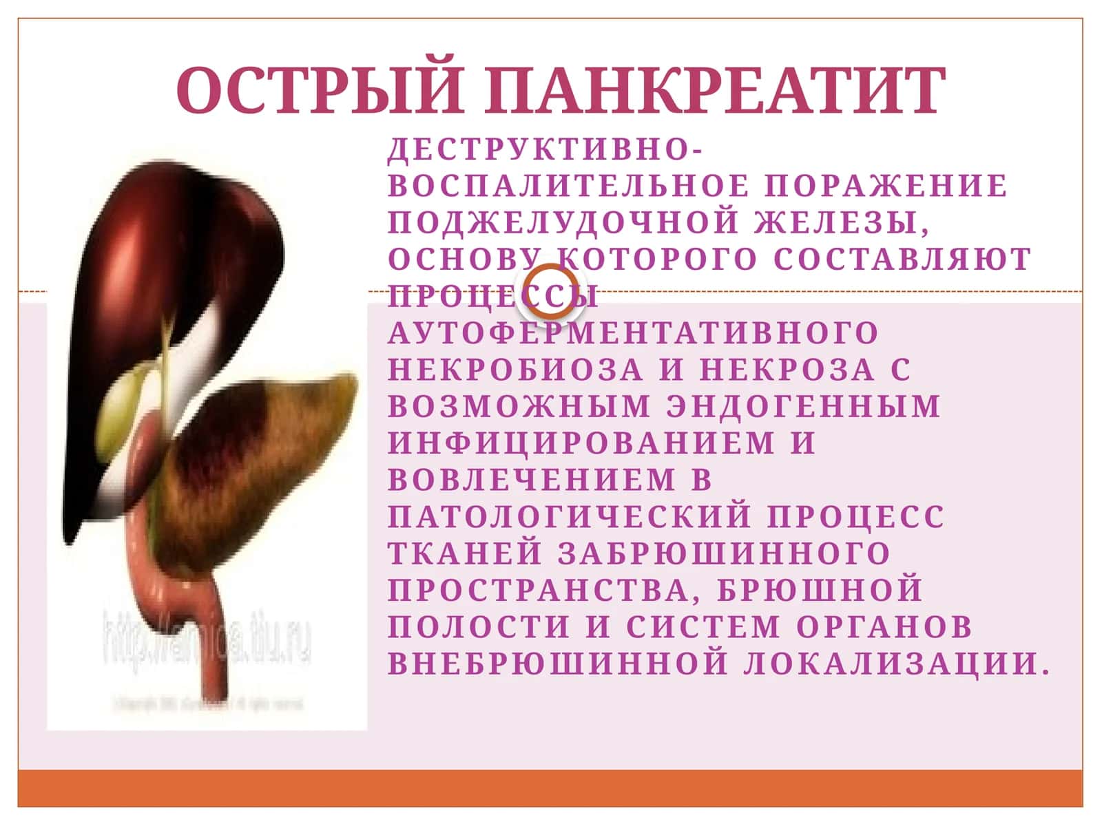 Острый панкреатит