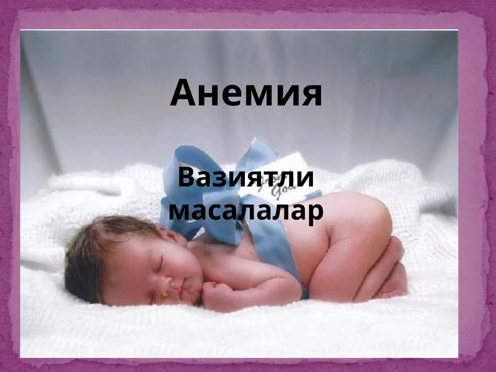 Анемия