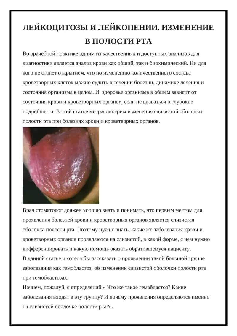 Гемобластозы