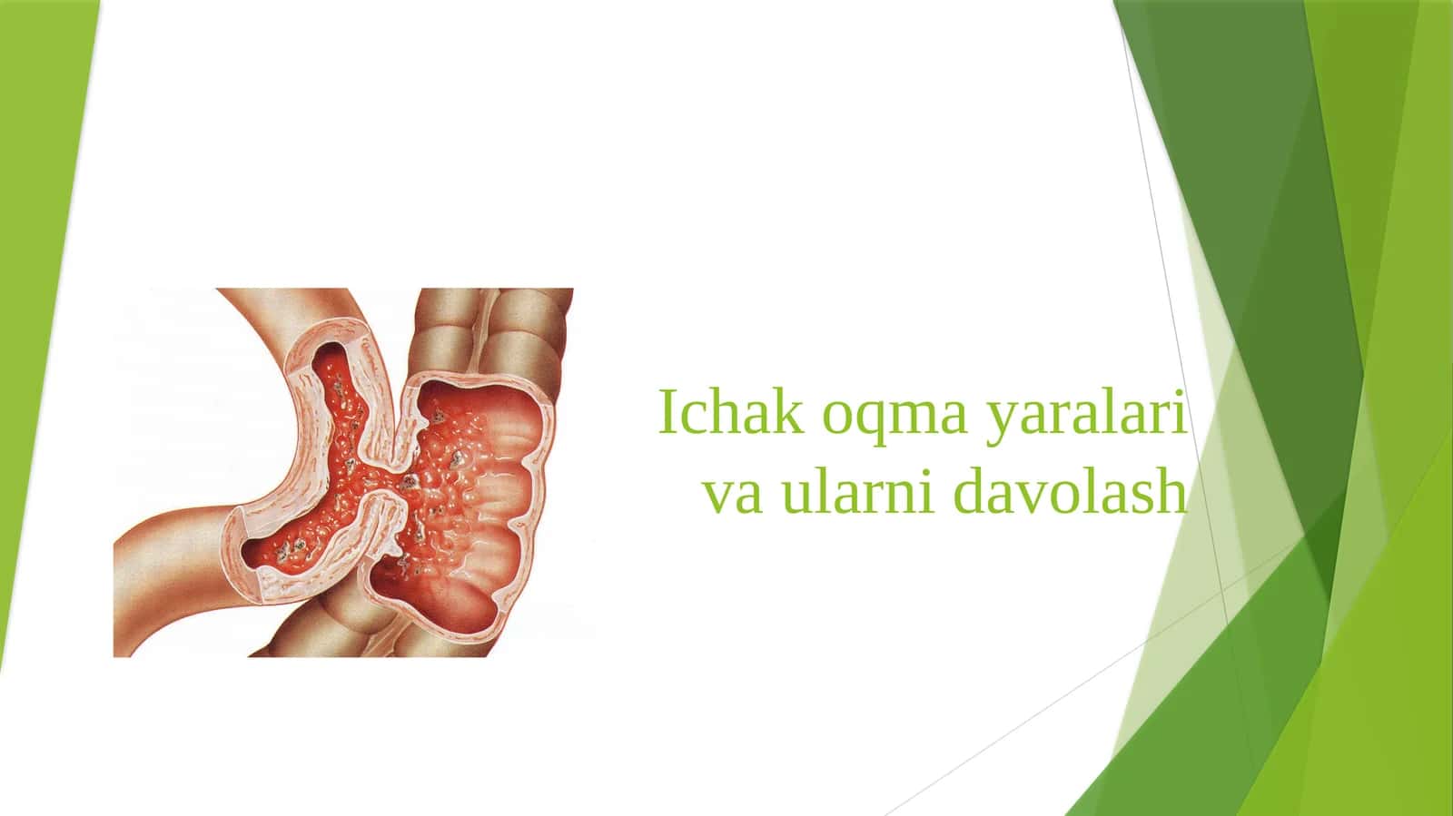 Ichak oqma yaralari va ularni davolash