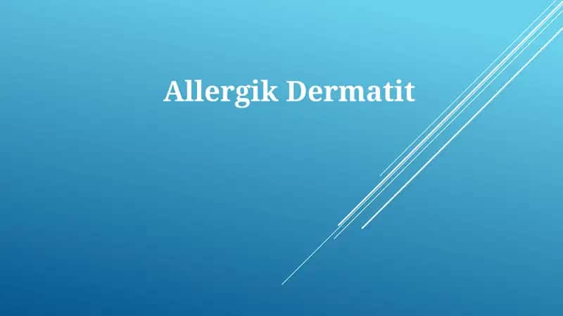 AllergikDermatit