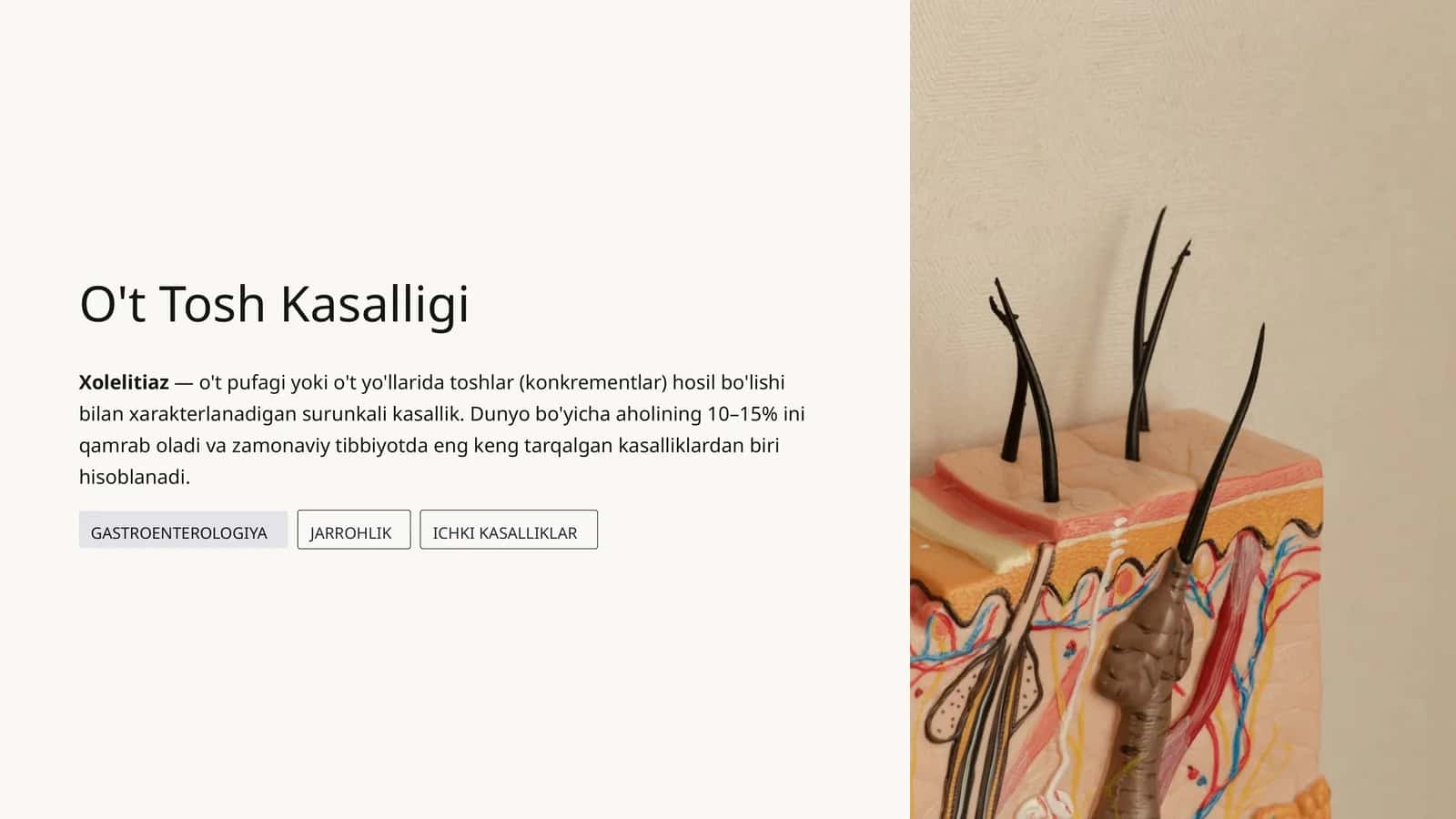 O't Tosh Kasalligi
