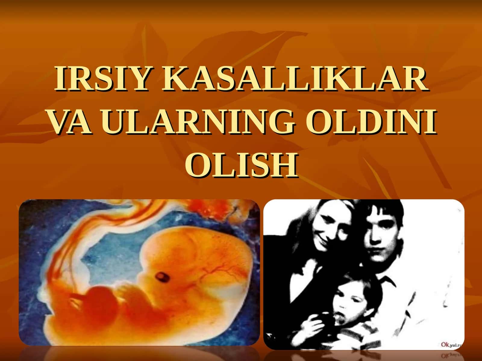 IRSY KASALLIKLAR VA ULARNING OLDINI OLISH