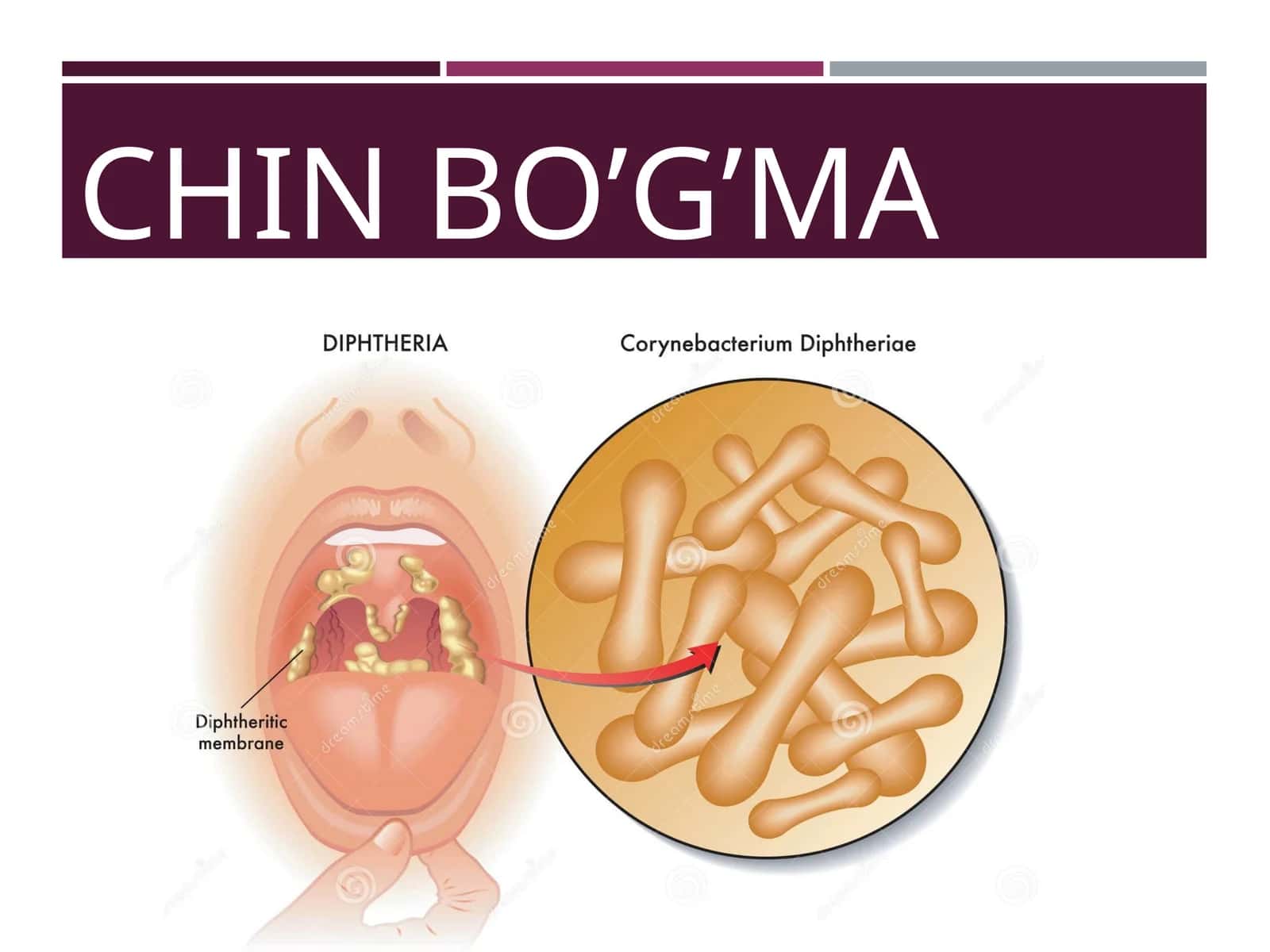 CHIN BO’G’MA