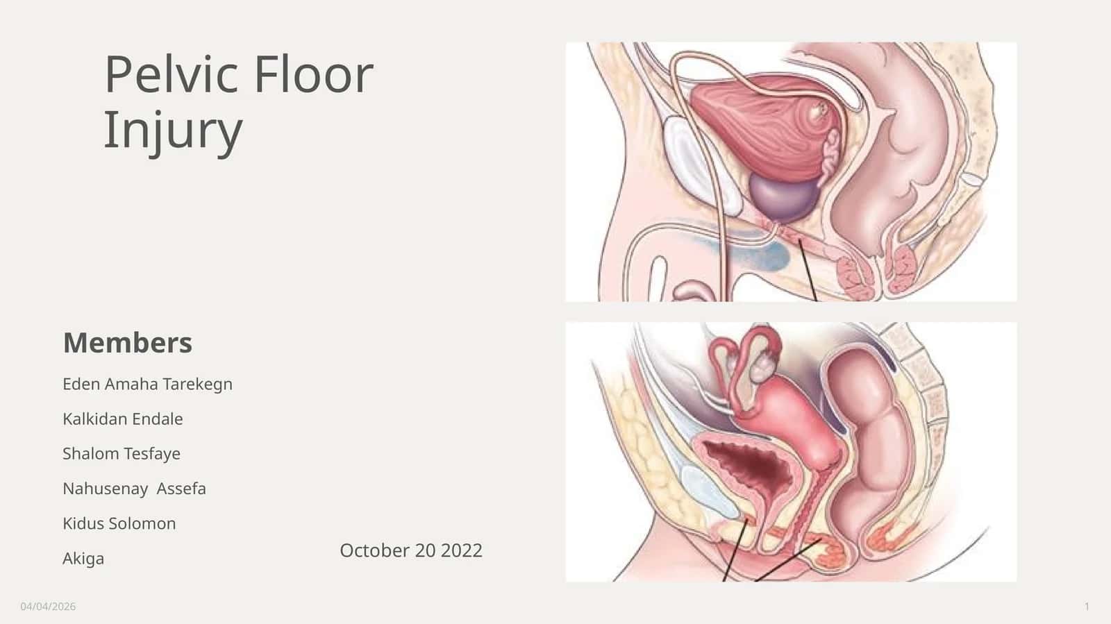 Pelvic Floor Injury