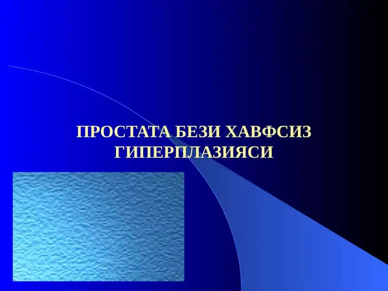 Простата бези хавфсиз гиперплазияси