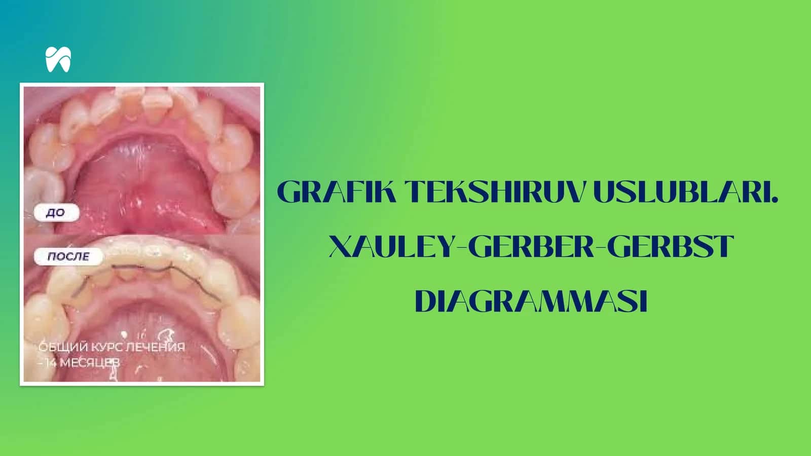 Xauley-Gerber-Gerbst Diagrammasi