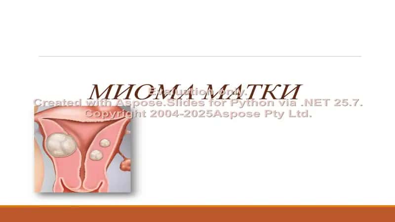 Миома матки
