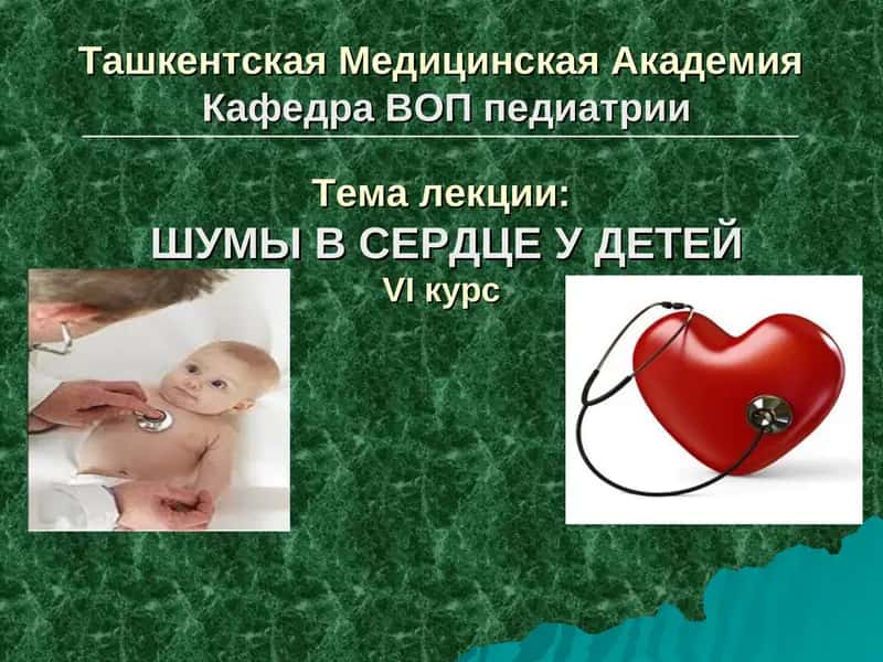 ШУМЫ В СЕРДЦЕ У ДЕТЕЙ
