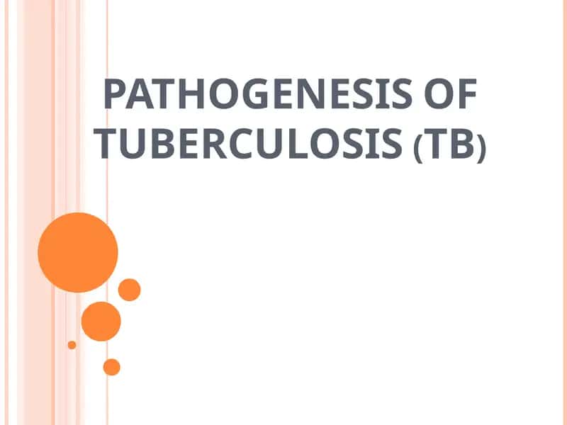 Tuberkuloz (SIL)