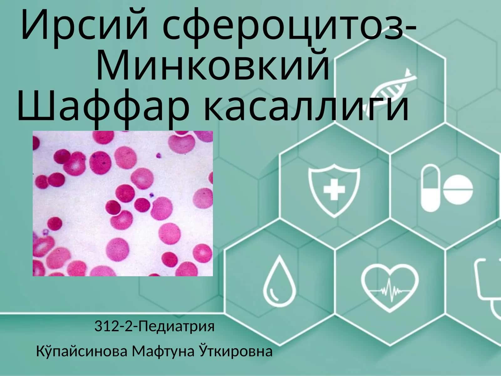 Ирсийсфероцитоз-МинковкийШаффаркасаллиги(gematologiya)