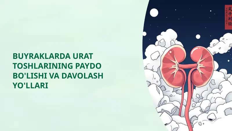 BUYRAKLARDA URAT TOSHLARINING PAYDO BO'LISHI VA DAVOLASH YO'LLARI