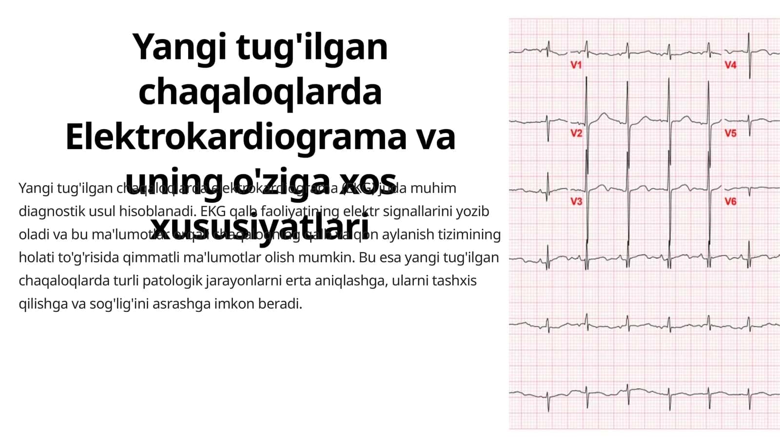 Yangi tug'ilgan chaqaloqlarda Elektrokardiograma va uning o'ziga xos xususiyatlari