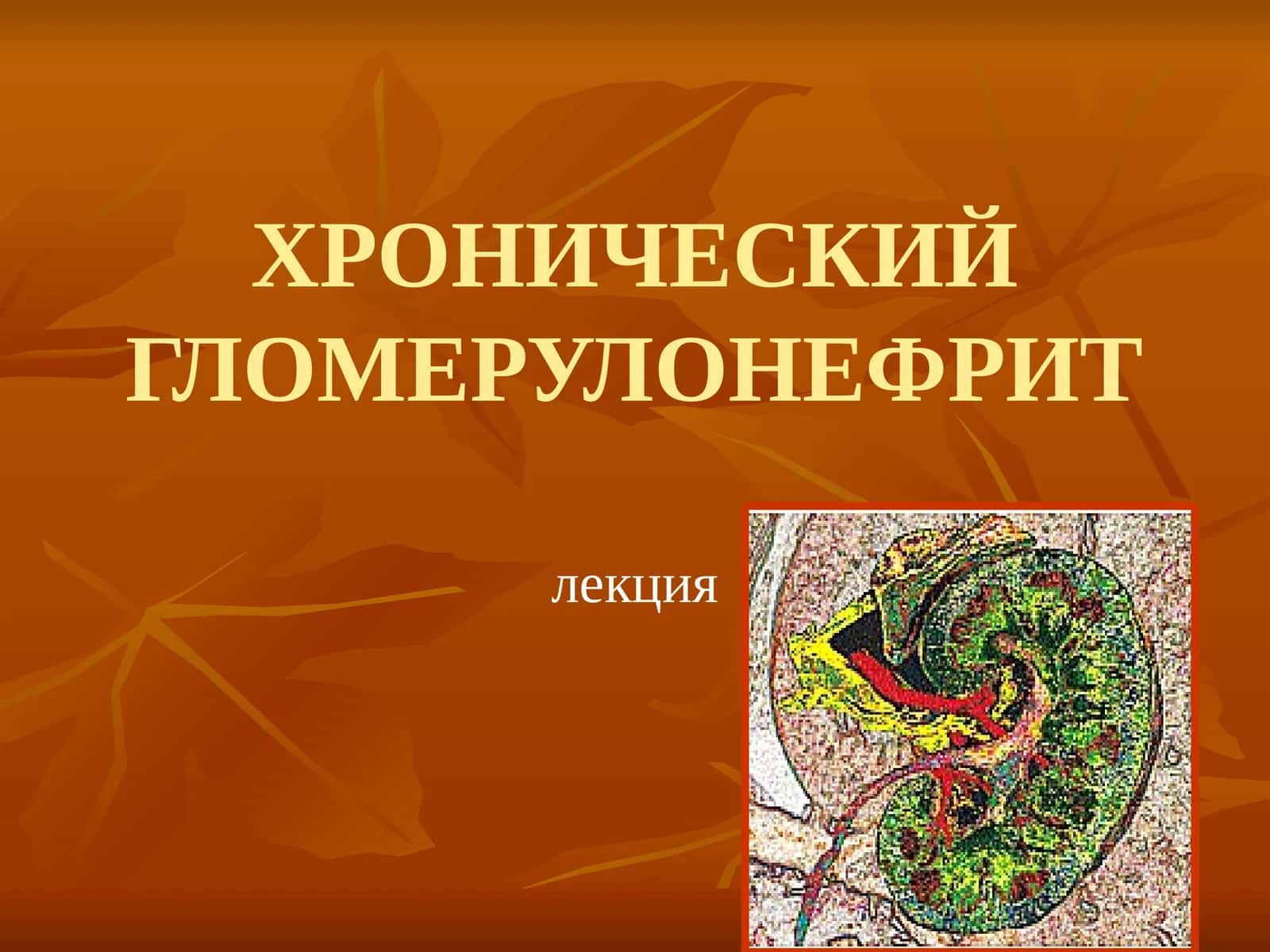 ХРОНИЧЕСКИЙ ГЛОМЕРУЛОНЕФРИТ