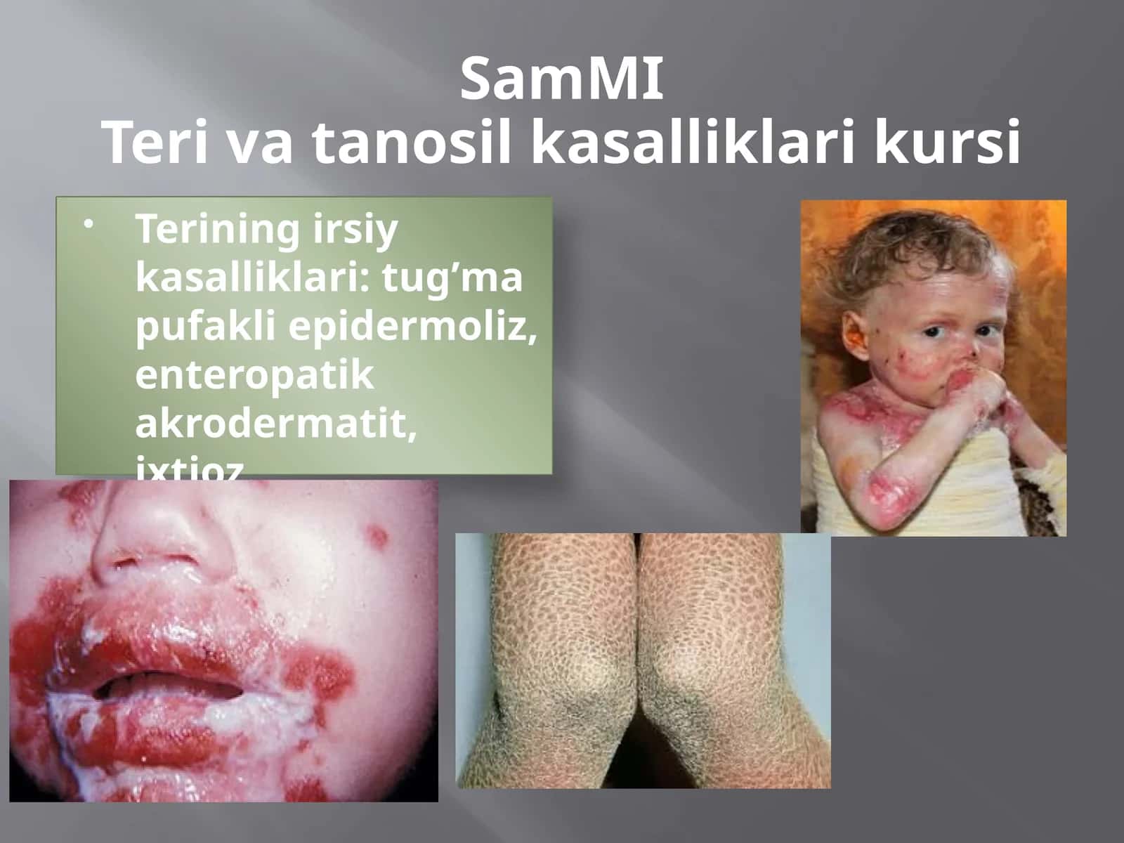 SamMITeri va tanosil kasalliklari kursi