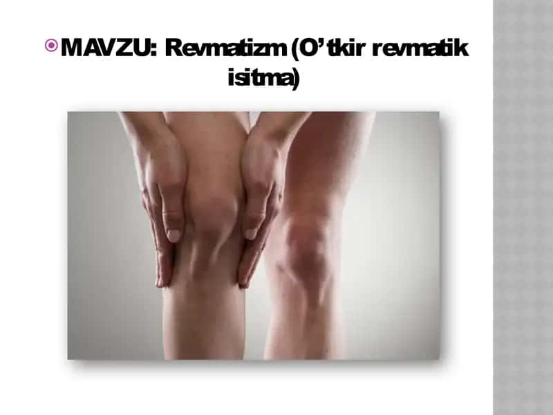 Revmatizm "O’tkir revmatik isitma"
