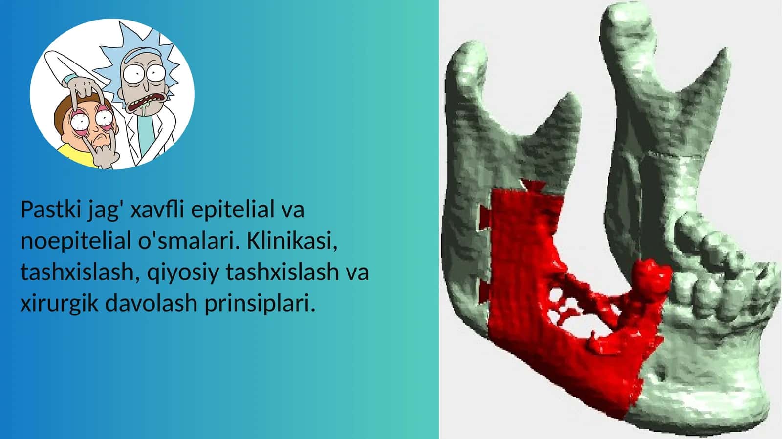 Pastki jag' xavfli epitelial va noepitelial o'smalari