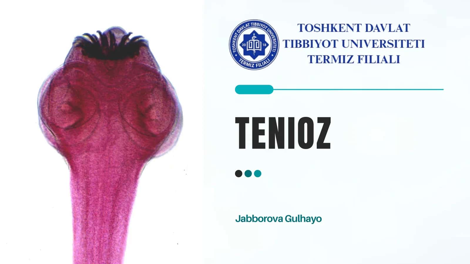 Tenioz