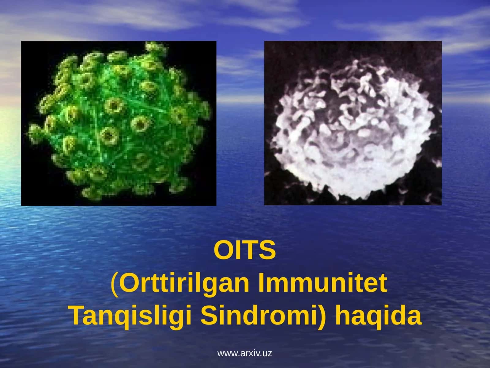 OITS(Orttirilgan Immunitet Tanqisligi Sindromi) haqida