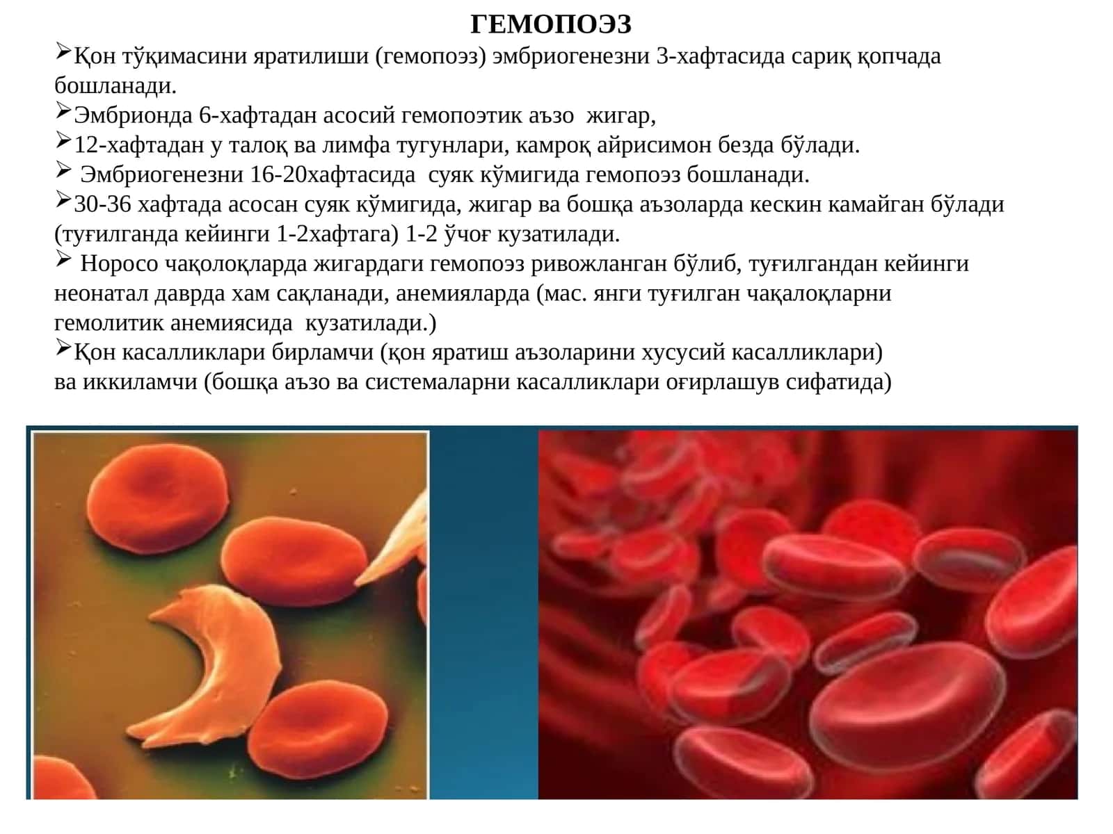 ГЕМОПОЭЗ
