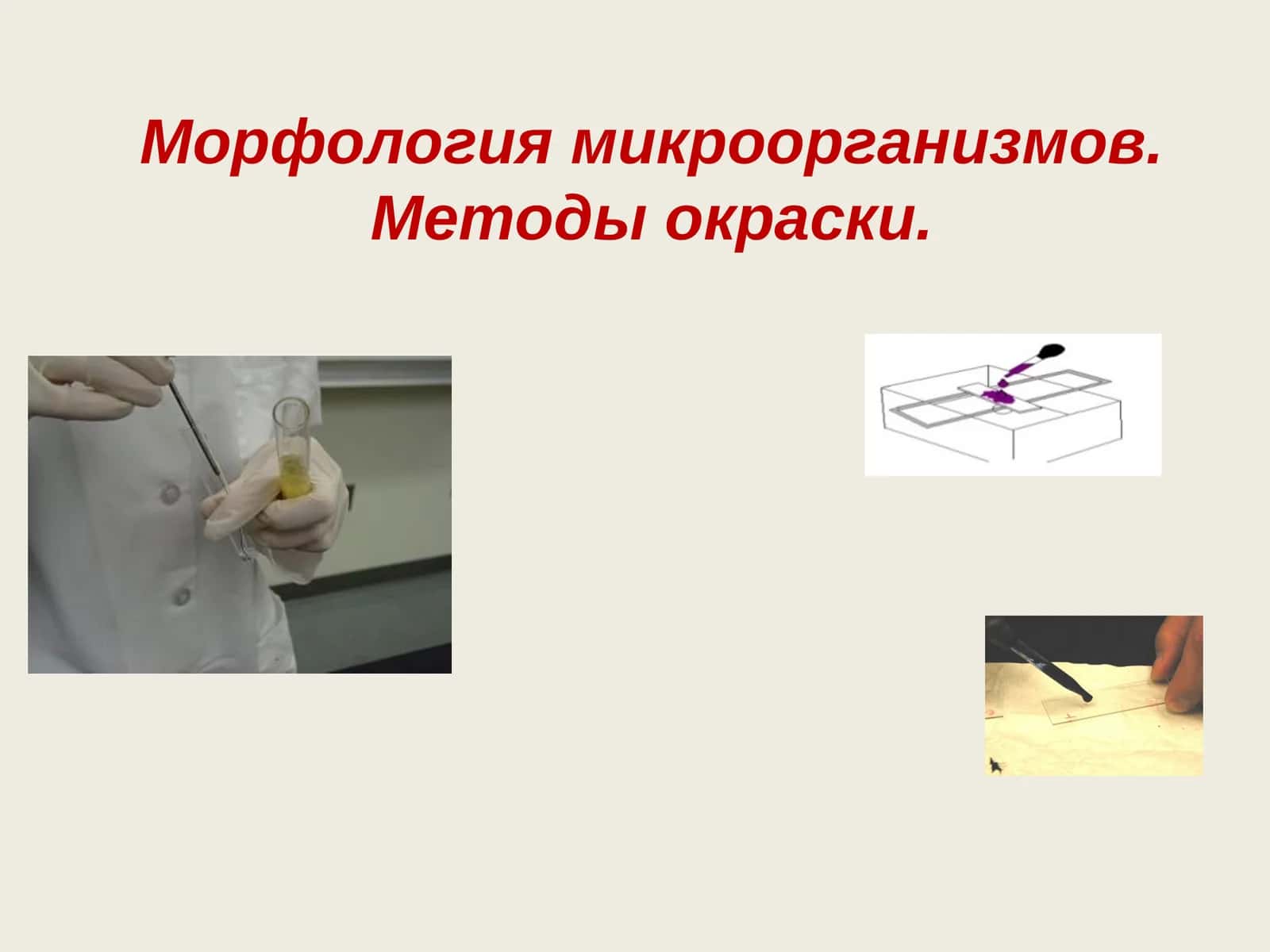 Морфология микроорганизмов.Методы окраски