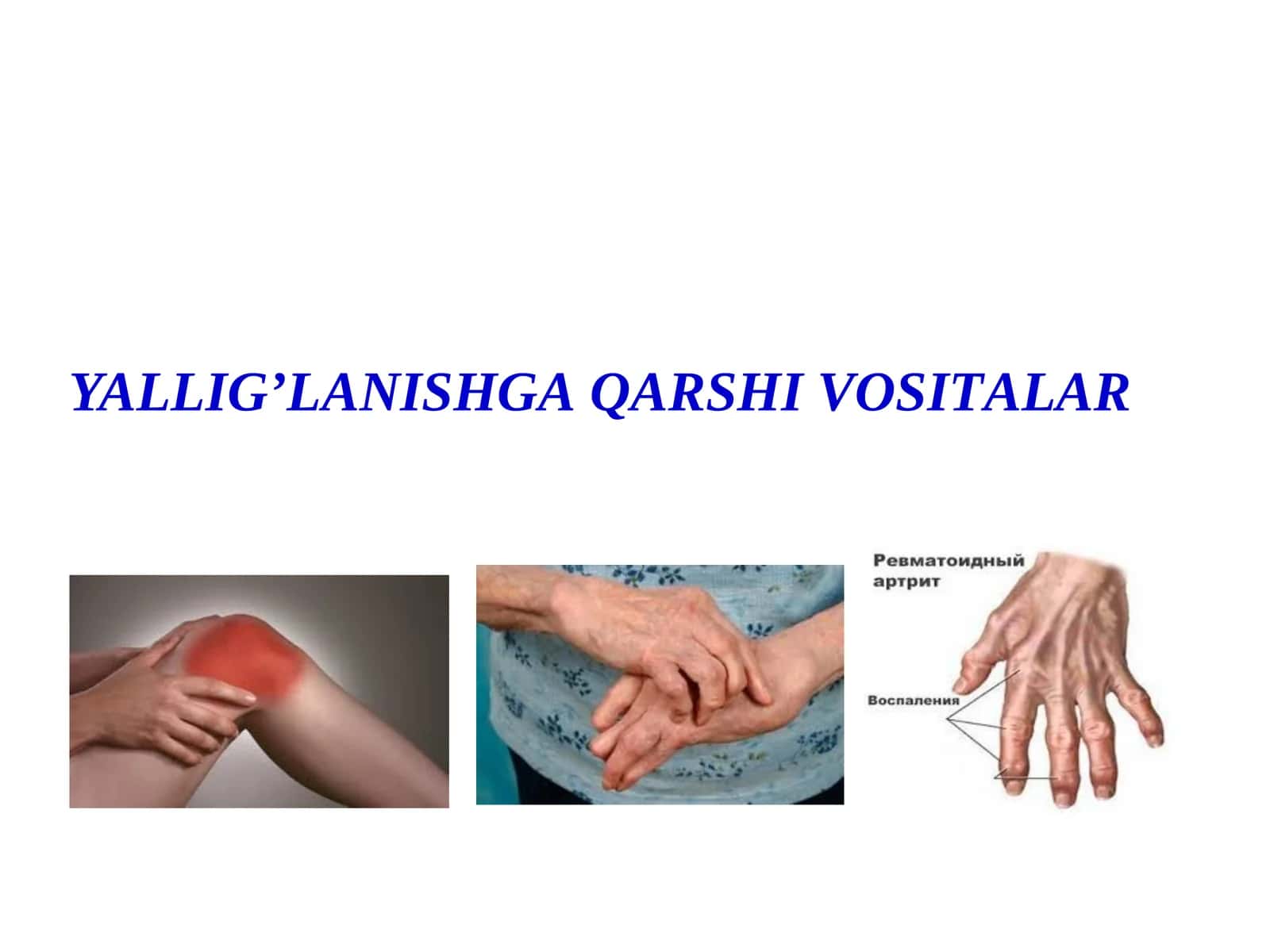 YALLIGʼLАNISHGА QАRSHI VOSITАLАR